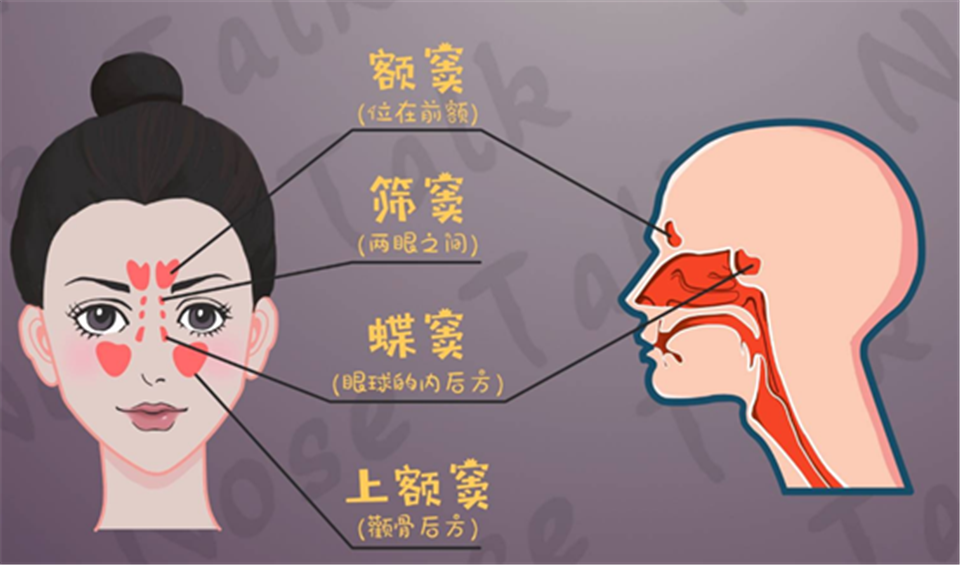 “感冒”一直不见好，你可能得的是鼻窦炎